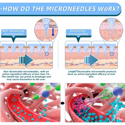 【Last Day Promotion 60% OFF🇦🇺】Lmipki® NIDDK-Tirzepatide Nano Microneedle Patch ✅（Zero Pain, 24/7 Release | Lose 20 kg FAST | 90% Sugar Drop | ）Get results in 7 days⚡